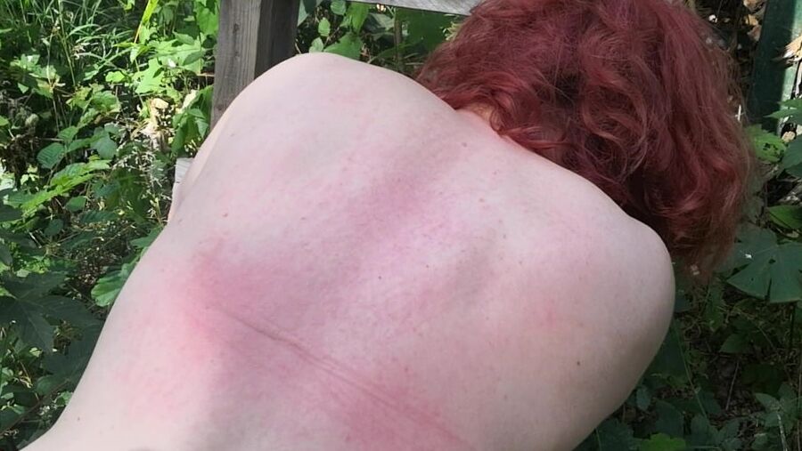 Whip my back in public forest