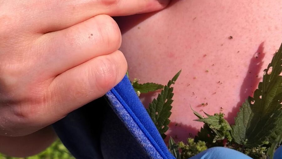 Put some nettles in my bra