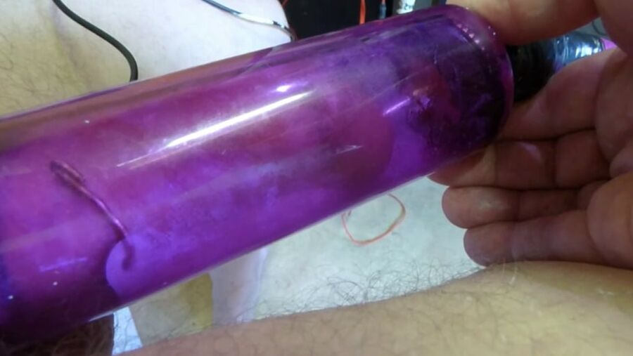 electro stimulation E-stim de paul