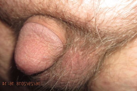 the evolution of a shrinking penis