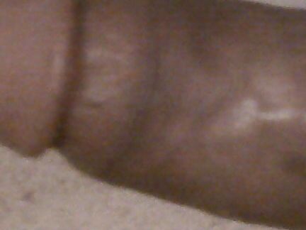 Sunny dick