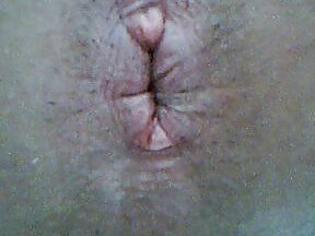 Filling my empty hole