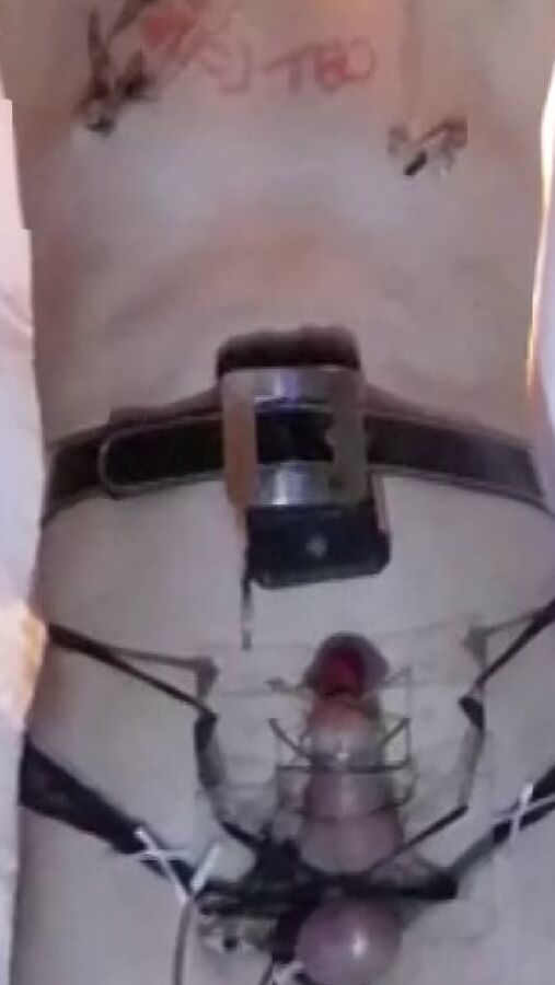 electro stimulation E-stim de paul