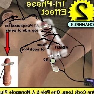 electro stimulation E-stim de paul