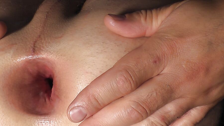 My gaping asshole ,cm okt. gape ass cock