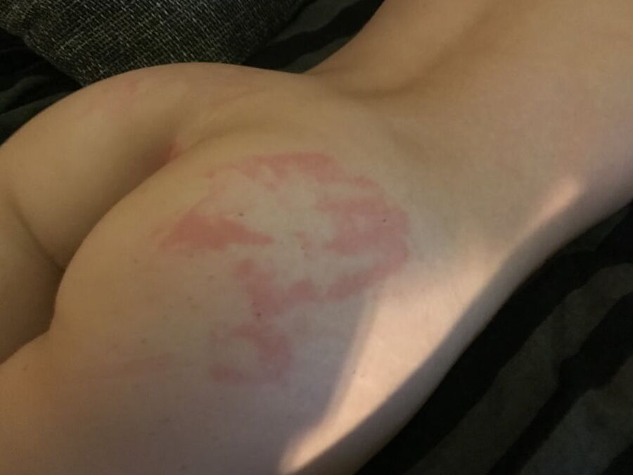 Marks on my Body