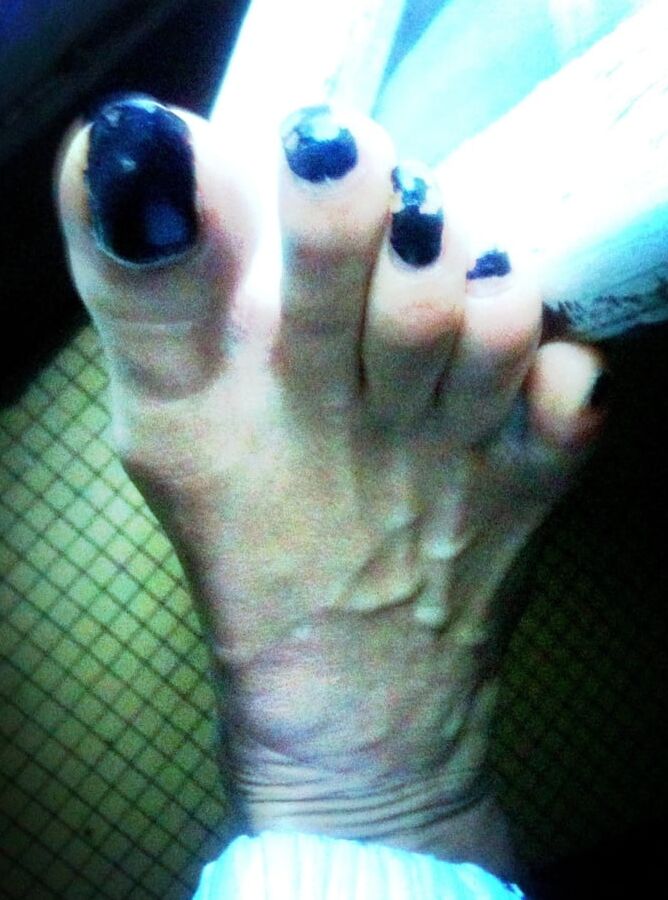 Asian ts feets, soles, toenails mix