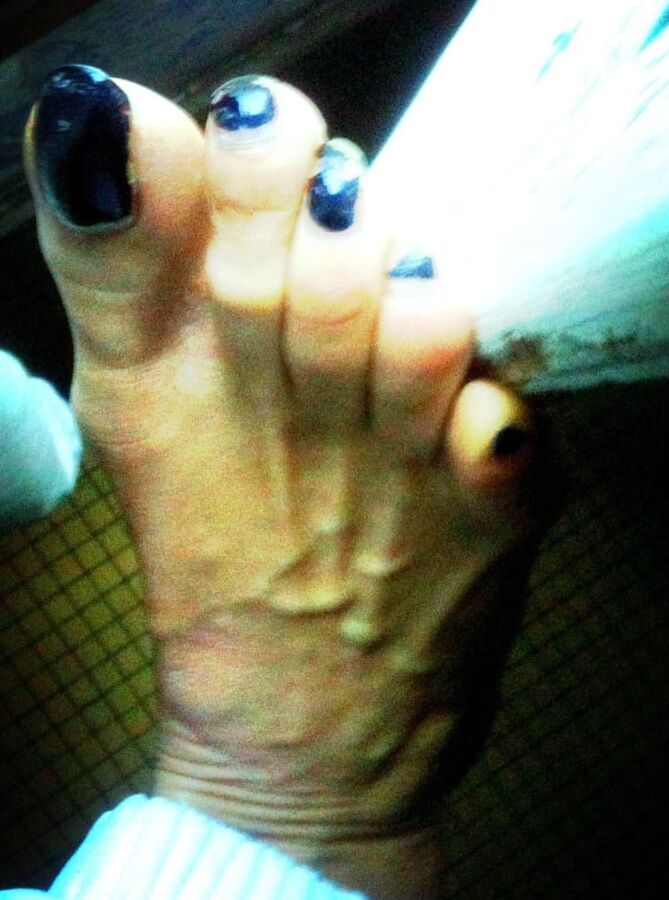 Asian ts feets, soles, toenails mix