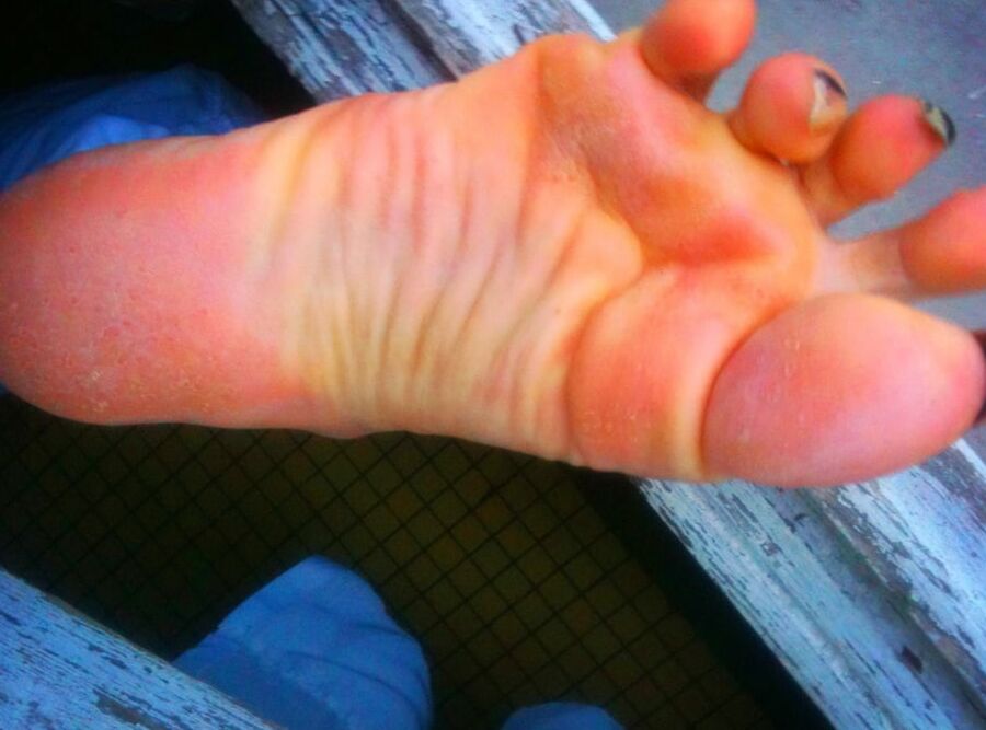 Asian ts feets, soles, toenails mix
