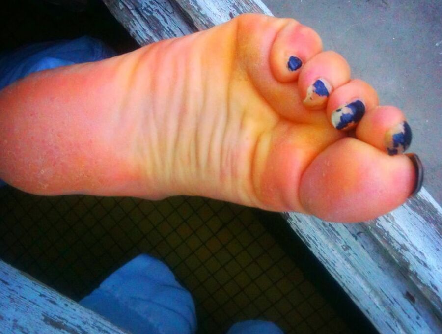 Asian ts feets, soles, toenails mix