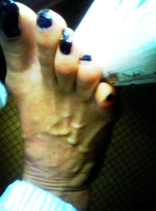 Asian ts feets, soles, toenails mix
