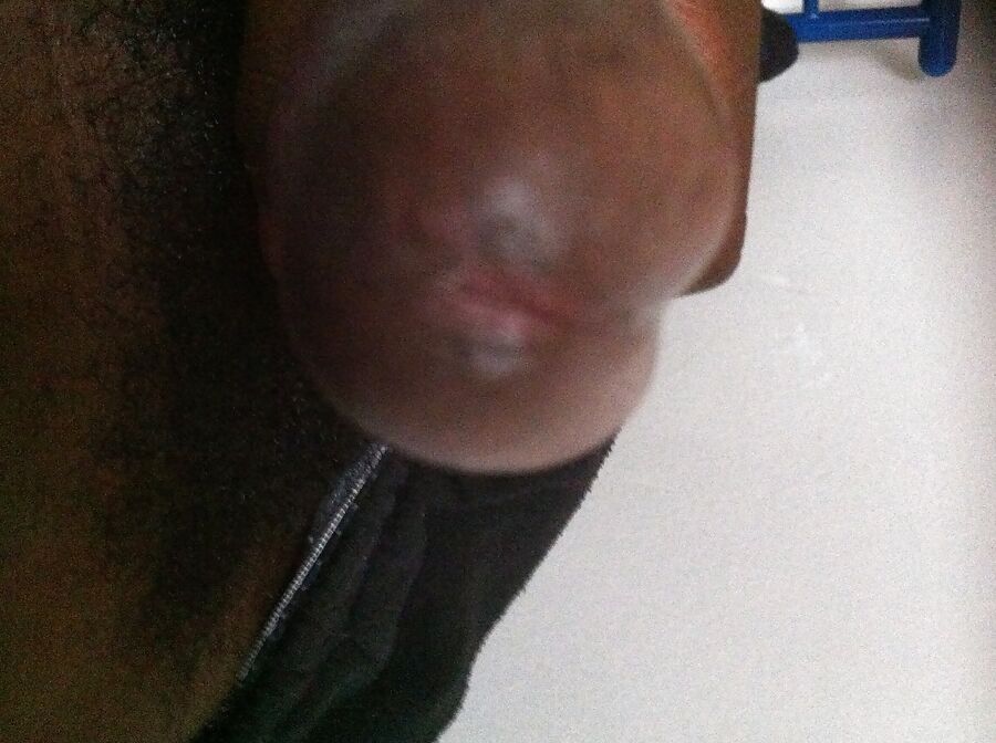 Pene y bolas