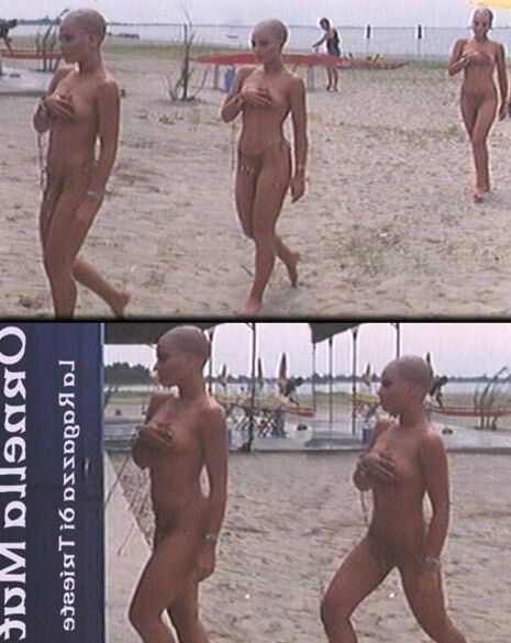 total expose