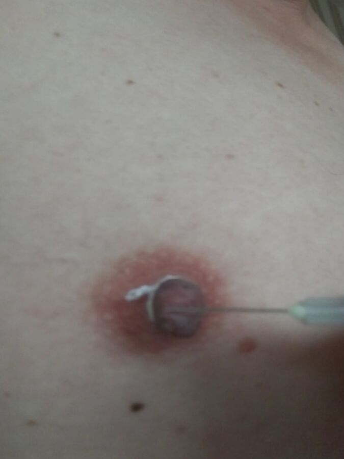 some more needles in my nipples