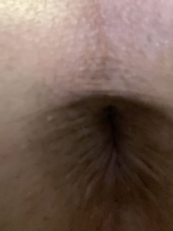 My gaped hole