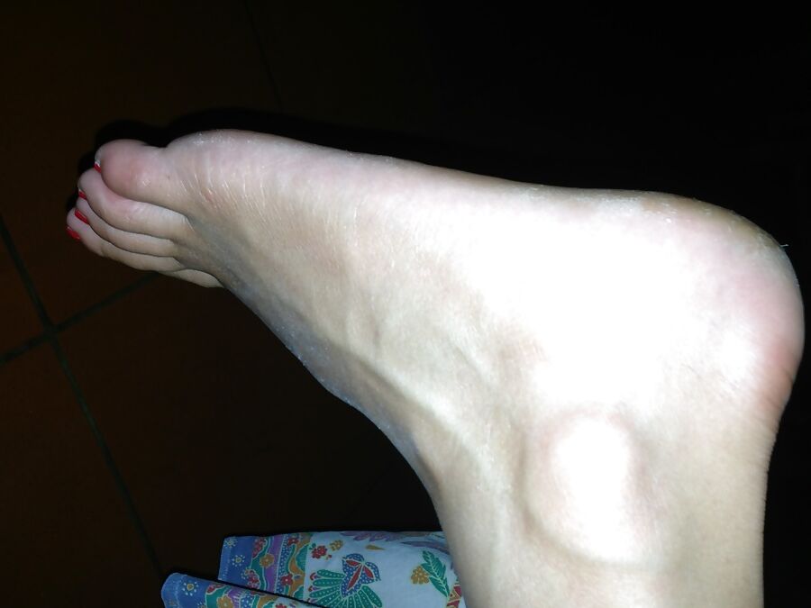 my wifes feet are so dried out they need humidity