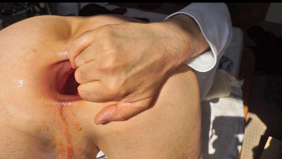 Fist fuck ad big cup in my asshole