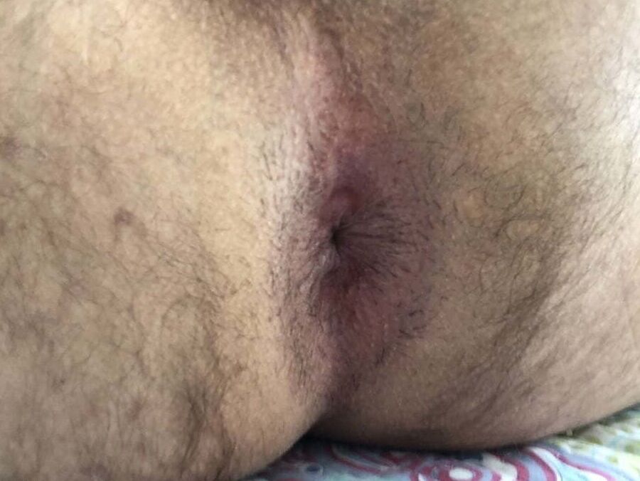 Close Up Hole