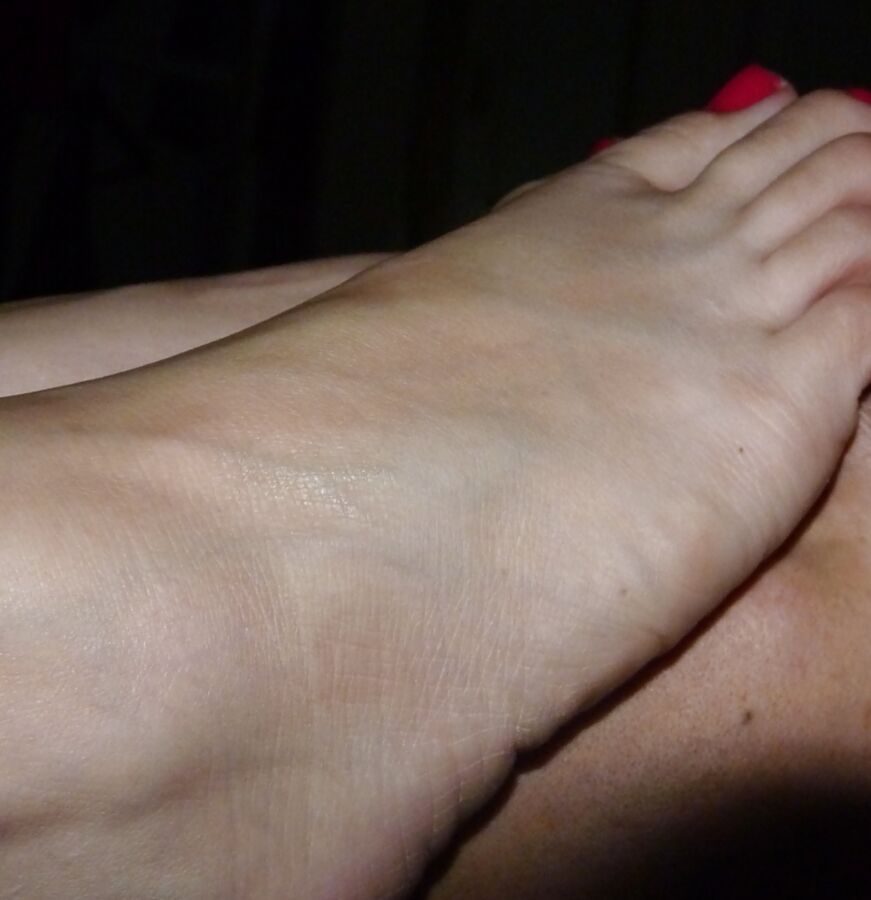 my wifes feet are so dried out they need humidity