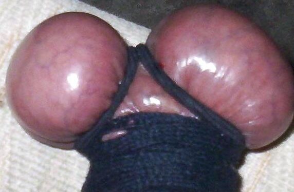 Bust His balls