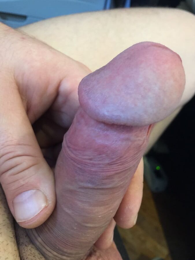 my-