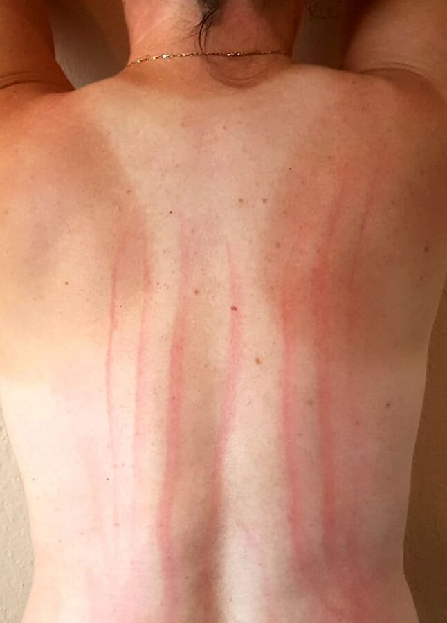 Marks