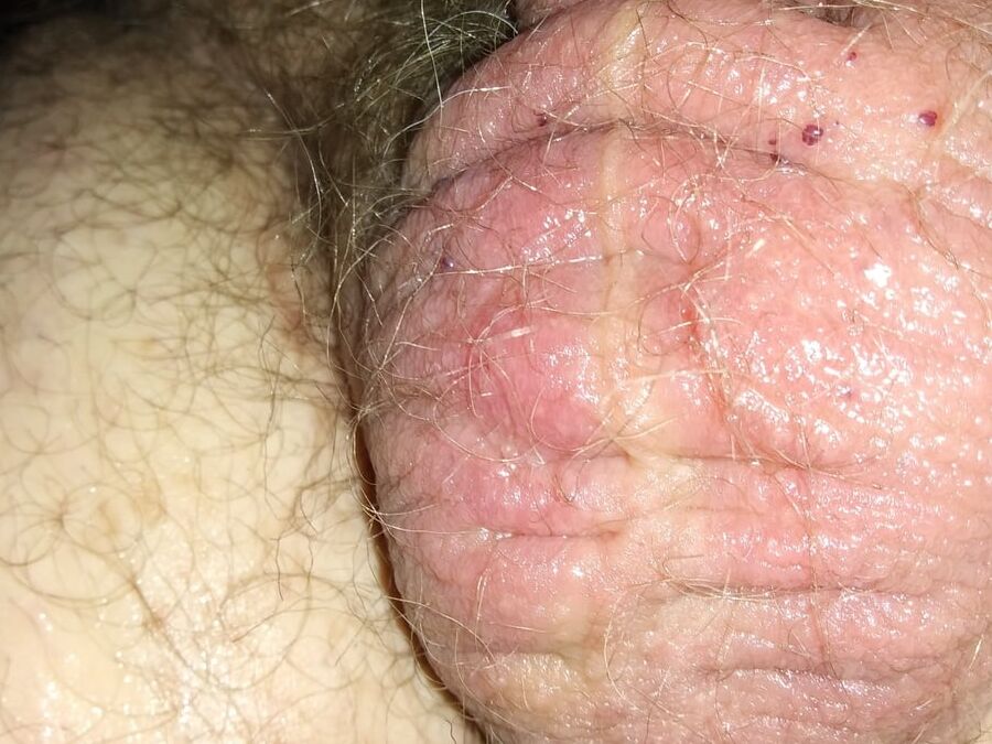 My meat
