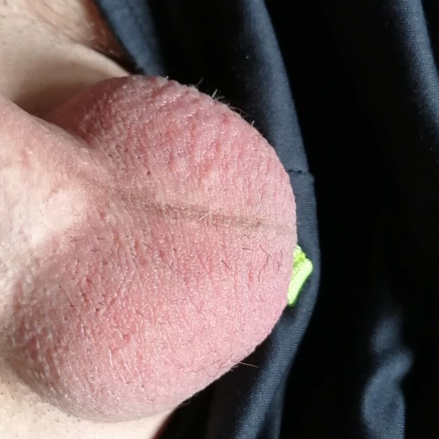 My Eggs