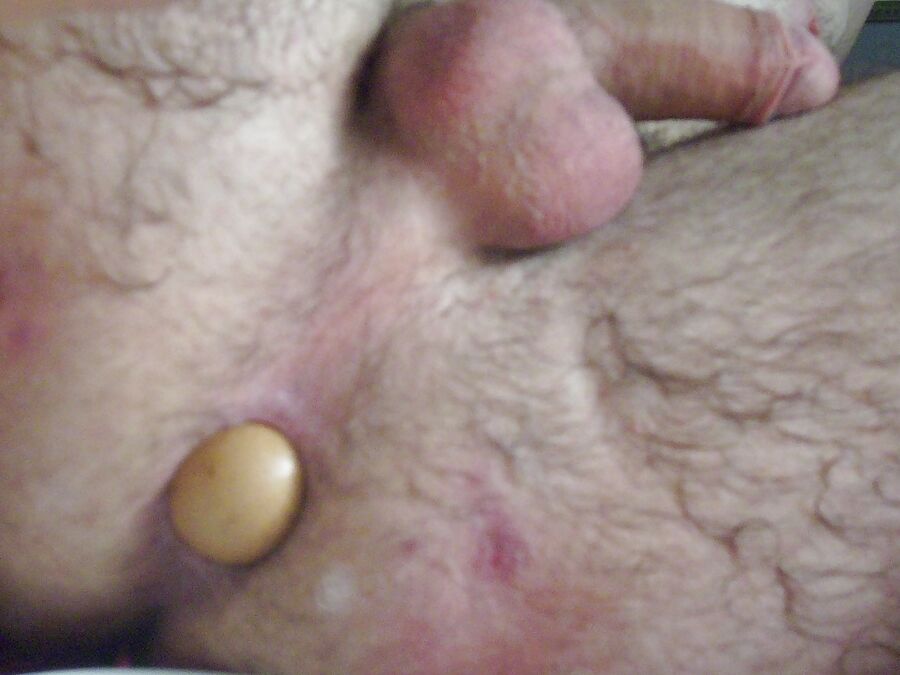 Insertions!