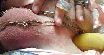 Insertions!