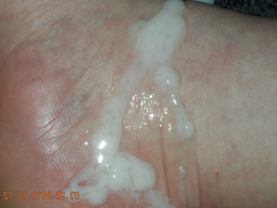 My Foot