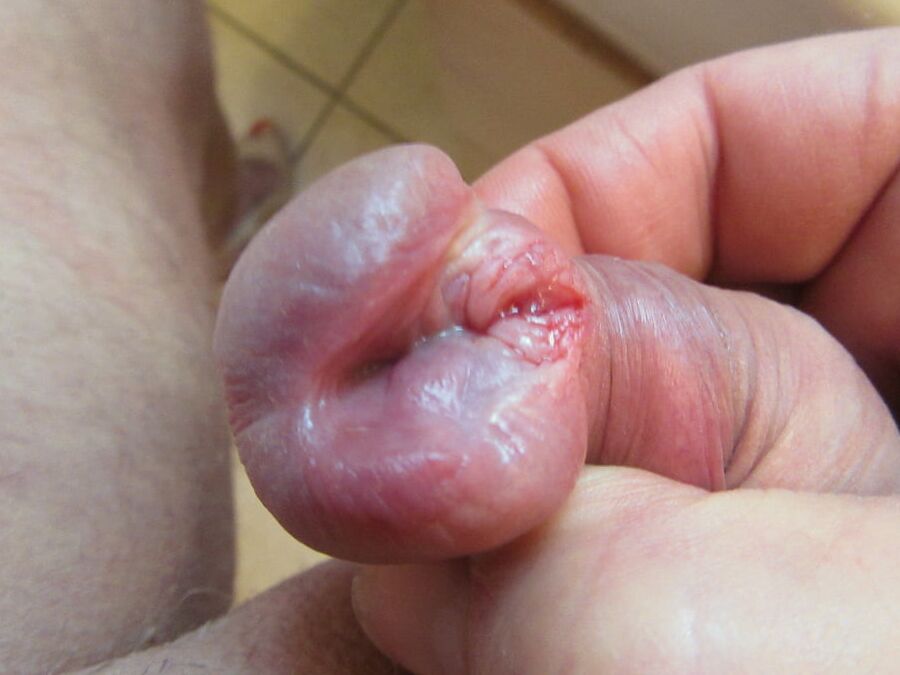 from a small to a big peehole