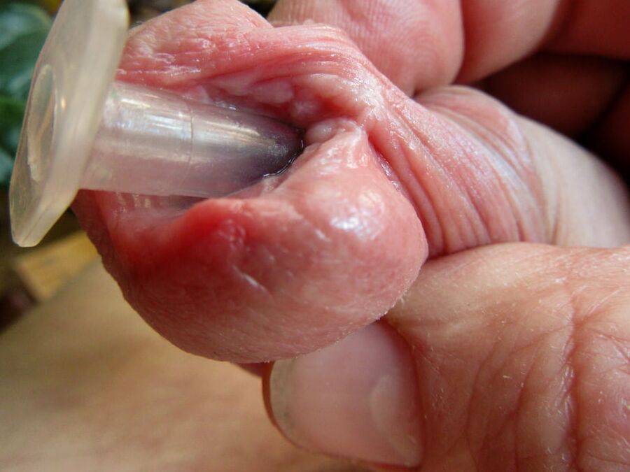 from a small to a big peehole