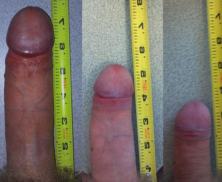 Penial size