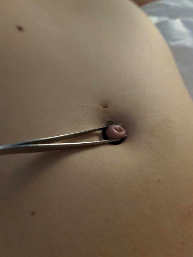 My Outie Belly Button Torture
