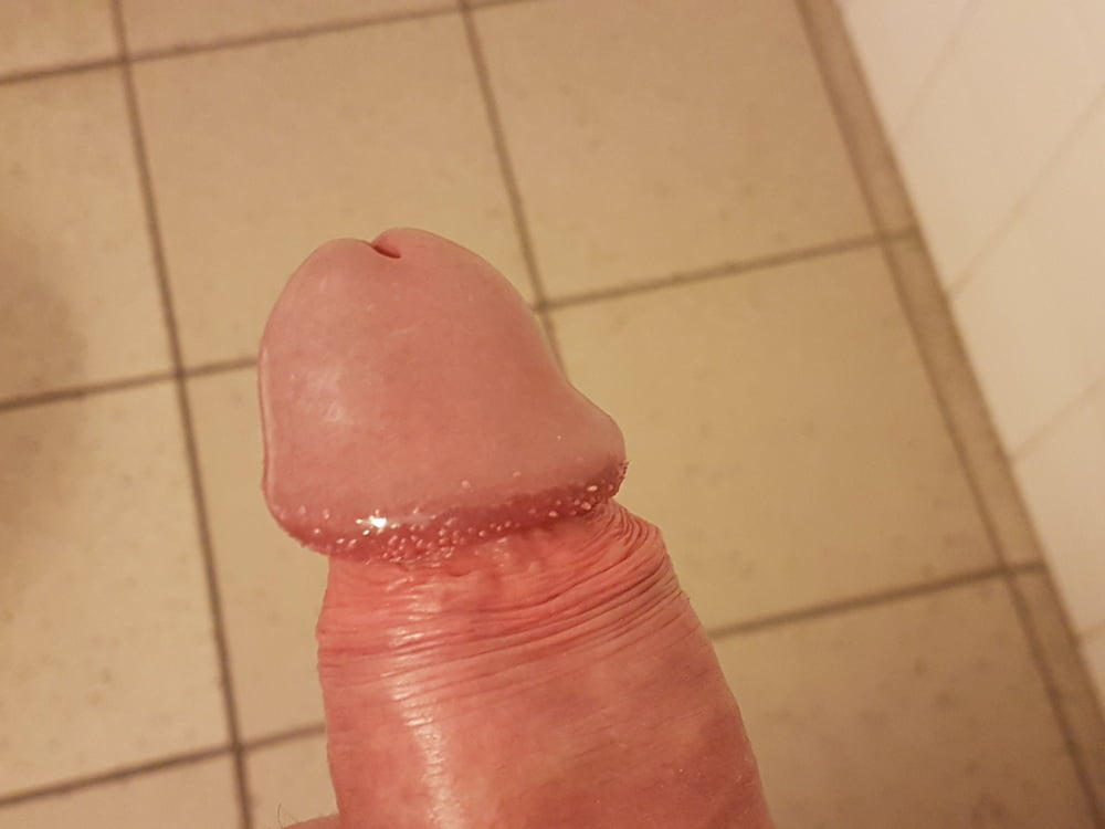 Gland