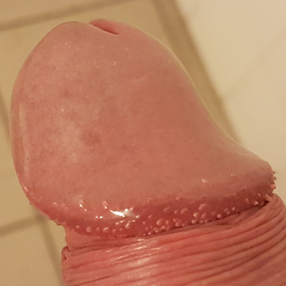 Gland