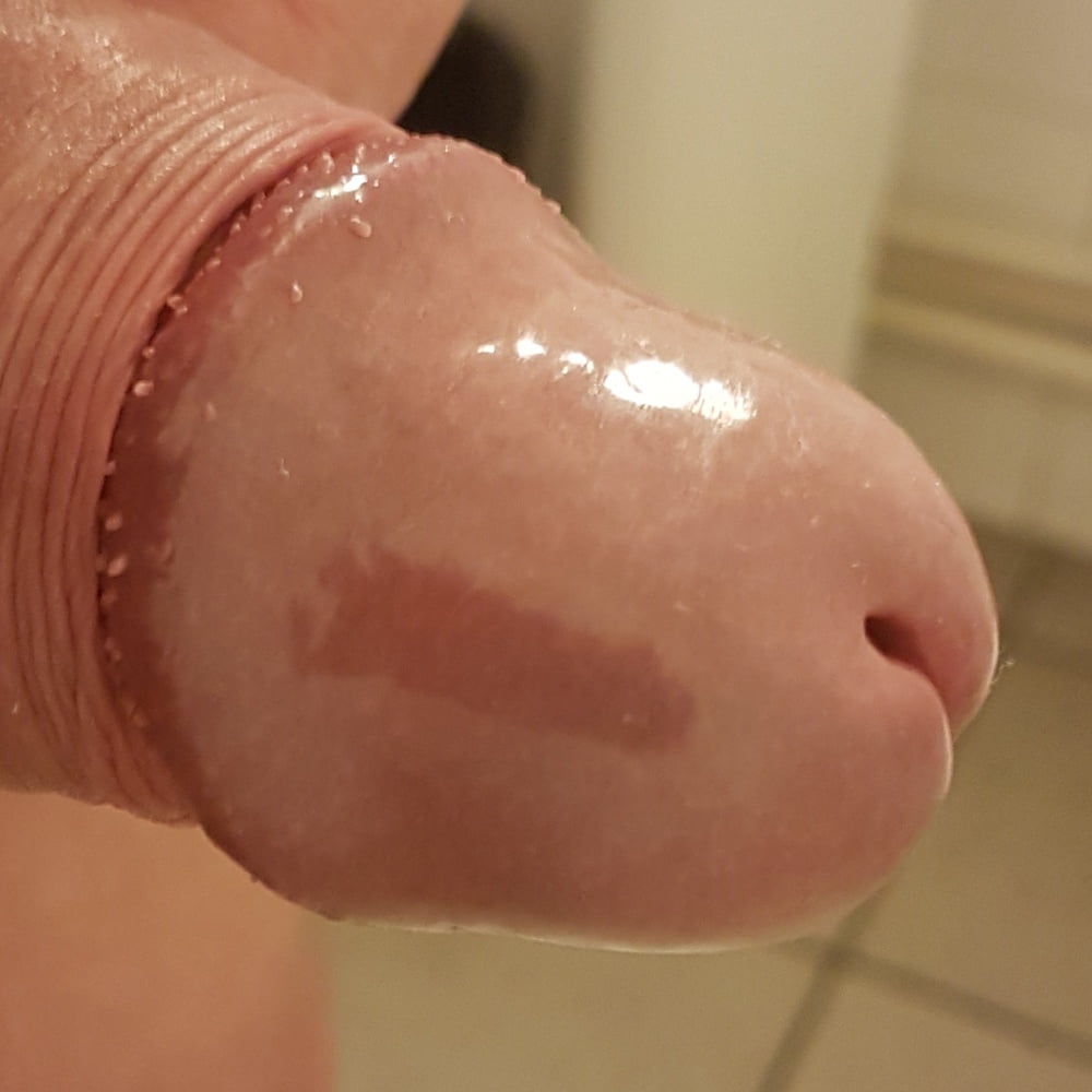 Gland
