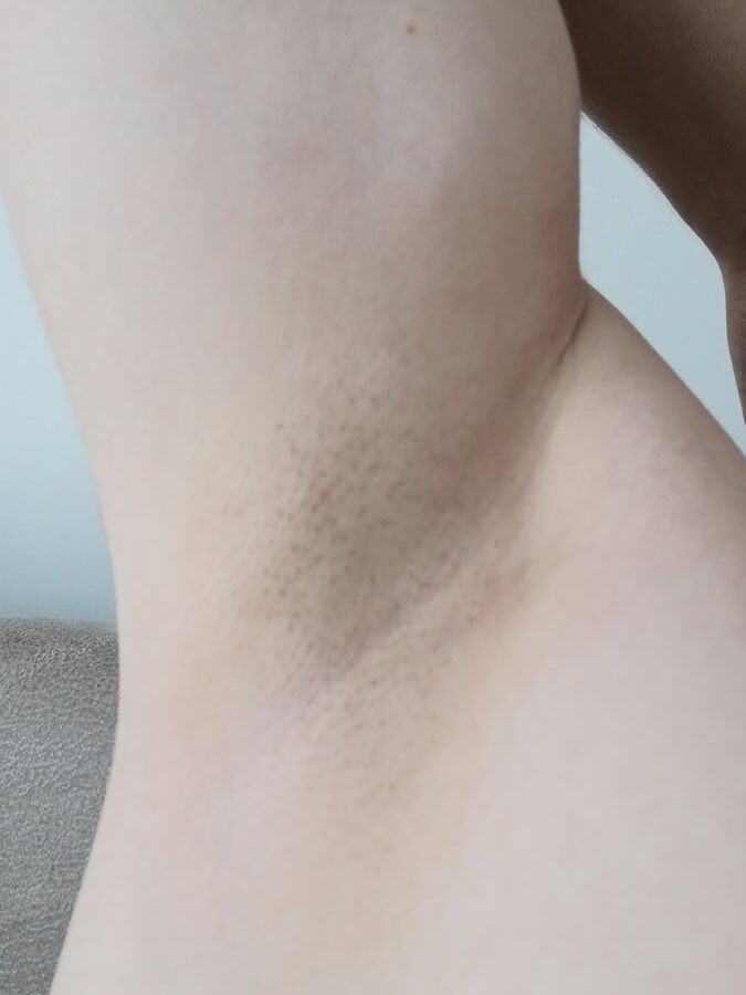 Young boy armpit