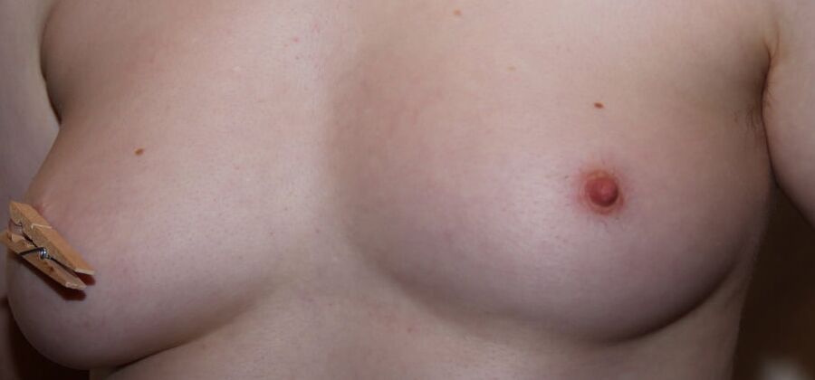 Tits with clamps