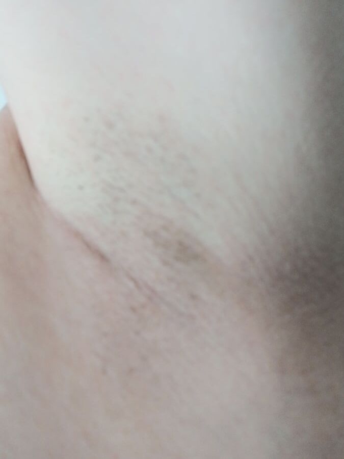 Young boy armpit