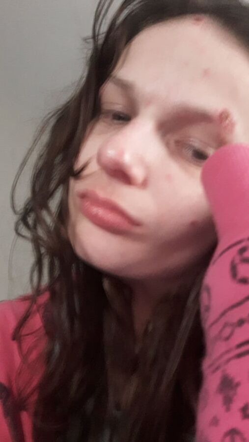 Me and my necked Ness