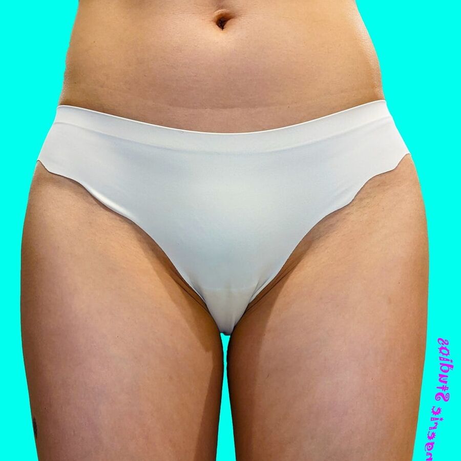 Camel TOE !!