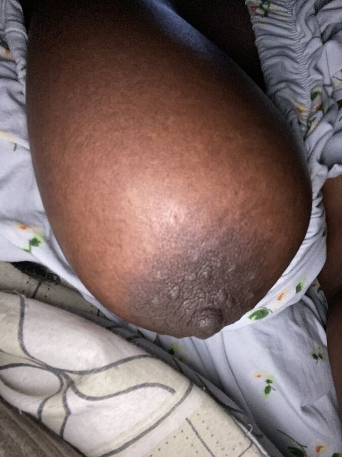 Tits