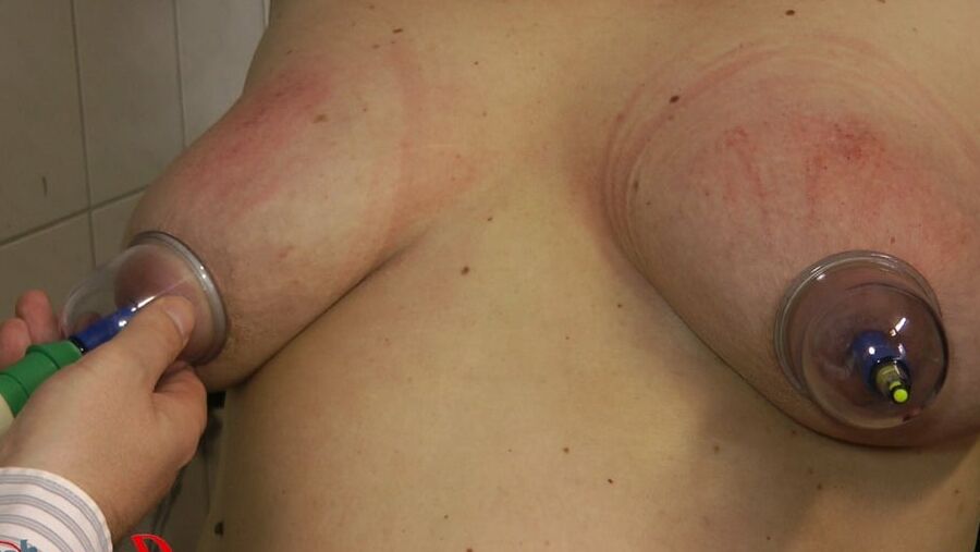 Sucked nipples