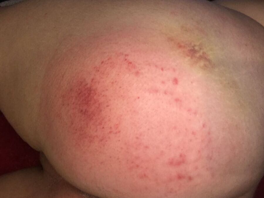 Posting my bottom after I'm punished