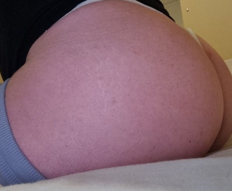 ASS