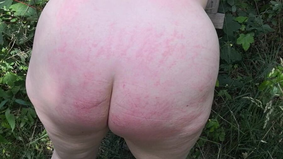 Whip my back in public forest