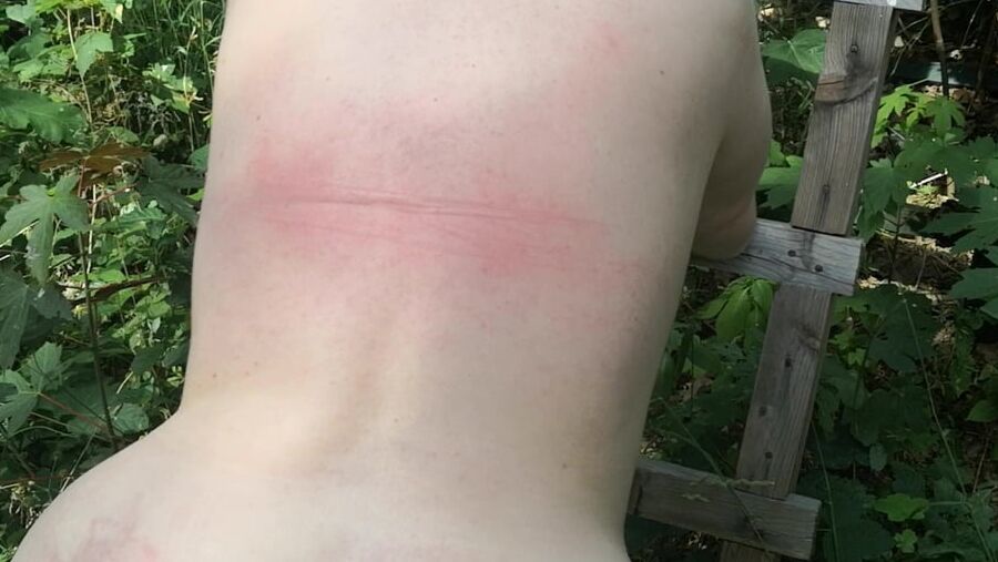 Whip my back in public forest