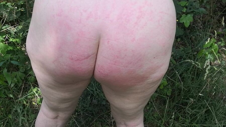 Whip my back in public forest